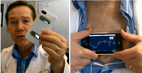 iPhonECG: convierte tu iPhone 4 en una máquina de Electrocardiograma .[Vídeo] 1