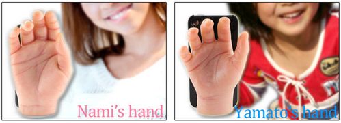 Softbank Hand Case, el protector para iPhone más ridículo y macabro que hayan inventado 4