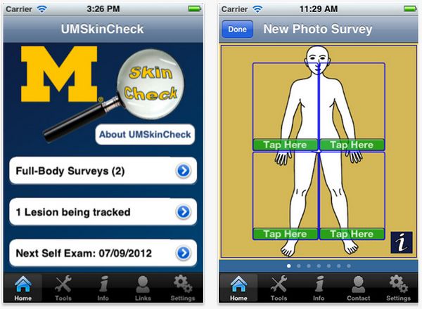 UMskincheck, aplicación gratuita de iOS para detectar cáncer de piel 1