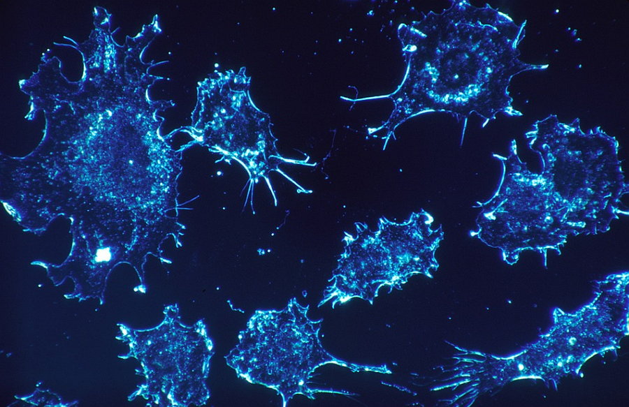 Chip Laberinto - Células Cancerosas - Universidad de Michigan