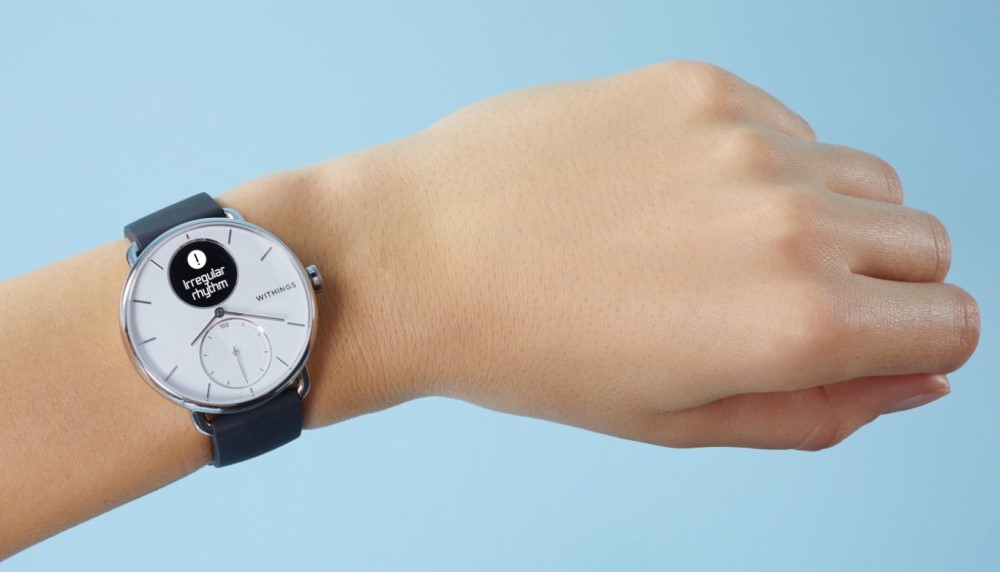 Withings ScanWatch, el smartwatch más completo en cuanto a funciones salud 1